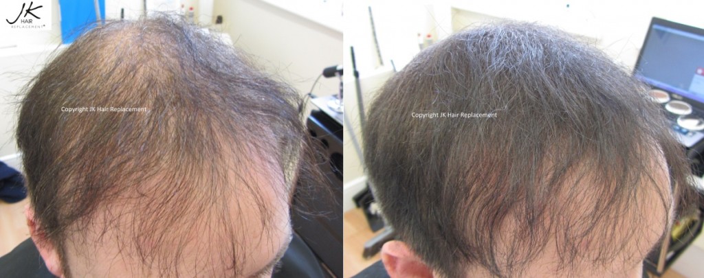 JK Scalp Shader before and after